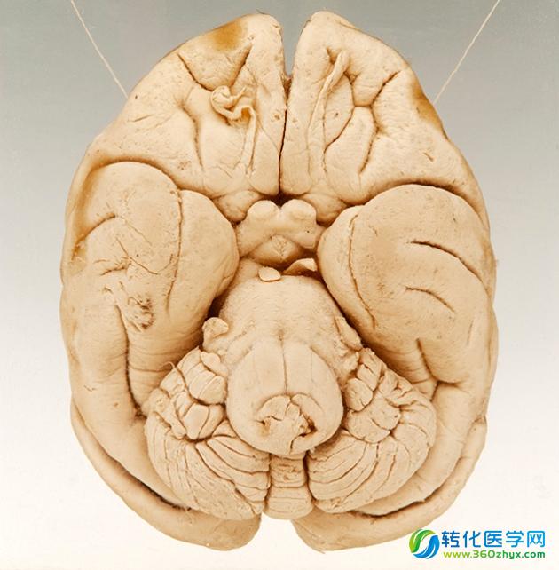 研究显示，脑脊液可以作为脑癌检测的潜在液体样本活检来源