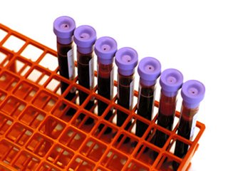 除了HbA1c，哪些指标可用于评估糖尿病预后？
