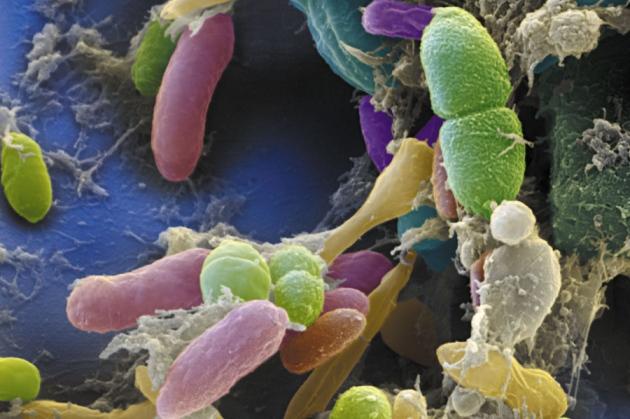 GUT : 肠道微生物组分分析可以作为早期肝细胞癌的靶向治疗的非侵入性生物标志物