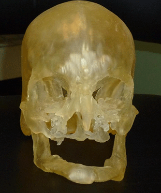 3D打印技术实现临床应用